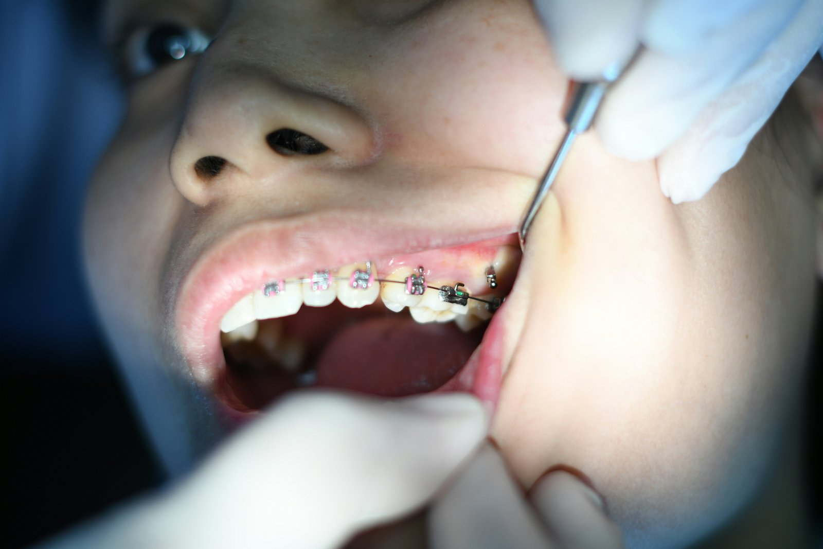 Dental and Vision — Photo: Atikah Akhtar